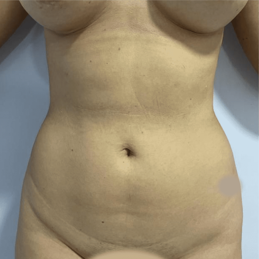 52