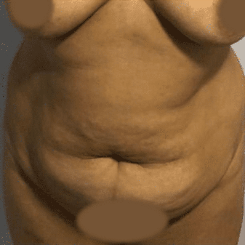 53