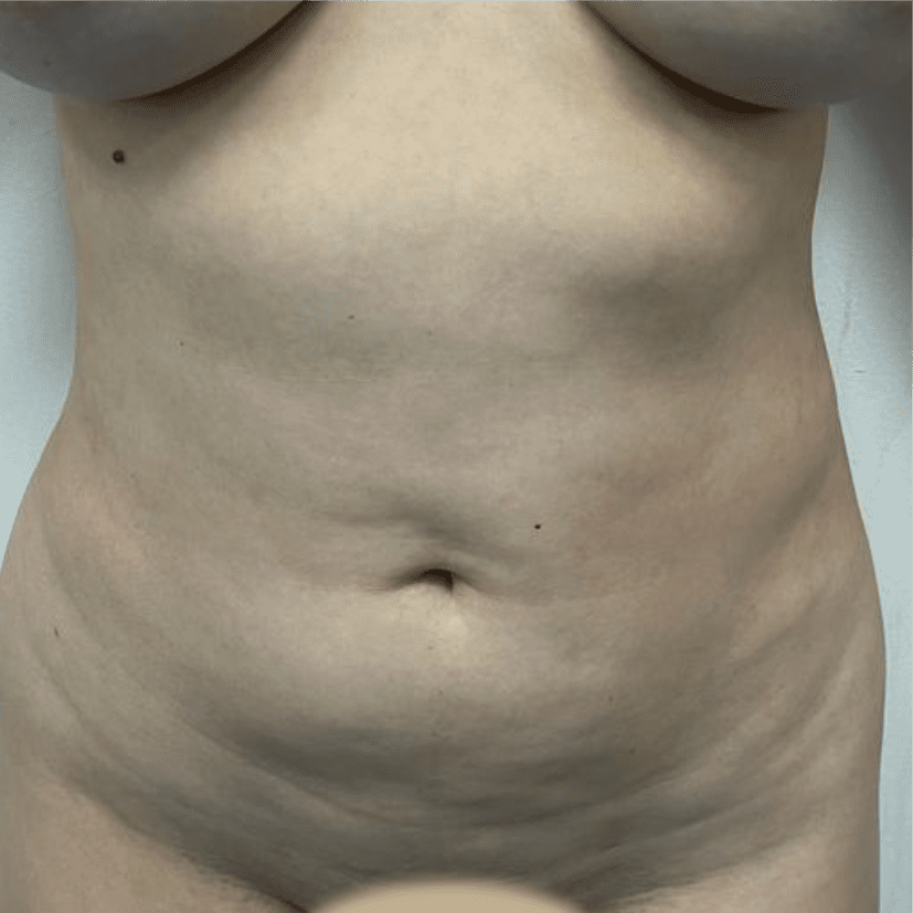 54